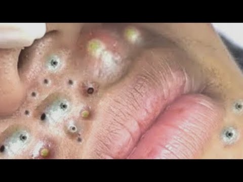 𝐏𝐫𝐨𝐟𝐞𝐬𝐬𝐢𝐨𝐧𝐚𝐥 𝐑𝐨𝐲𝐚𝐥 𝐅𝐚𝐜𝐢𝐚𝐥 𝐂𝐚𝐫𝐞 𝐰𝐢𝐭𝐡 𝐓𝐇 |