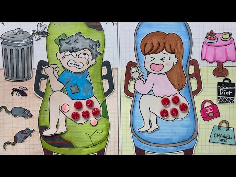 [💸paperdiy💸] POP THE PIMPLES | Care tips💰Poor vs Rich ⭐️여드름 짜기 종이놀이 #紙遊び #asmr