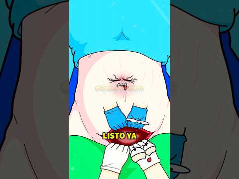 😱¿Qué ocurre realmente durante una cesárea?#shorts#funny#hot