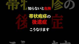 【知らないと危険】一生苦しむ？要注意な帯状疱疹の後遺症とは#医師#帯状疱疹#予防医学チャンネル