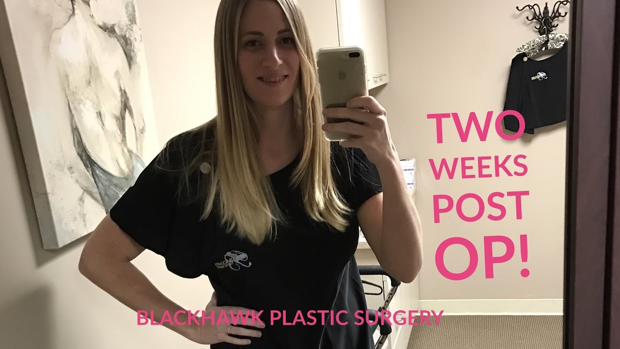 Woman two weeks post-surgery, smiling in clinic.