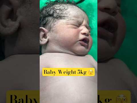 🍼 World’s Cutest 5 KG Baby – Must Watch! #shorts #oh #god #weight