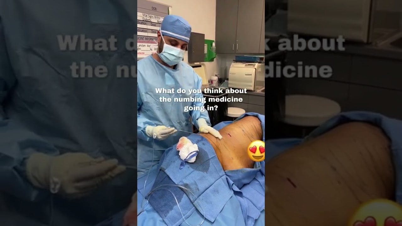 Surgeon administering numbing medicine during procedure.