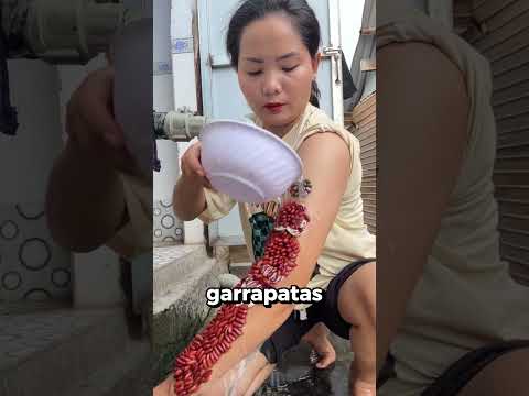 Esta Mujer está llena de garrapatas! 😨 #shorts