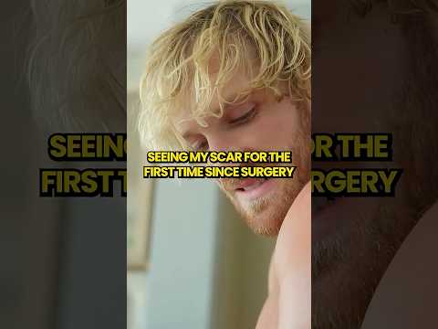SEEING MY SCAR FOR THE FIRST TIME SINCE SURGERY #loganpaul #wwe #shorts