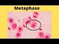Understanding Metaphase in Mitosis
