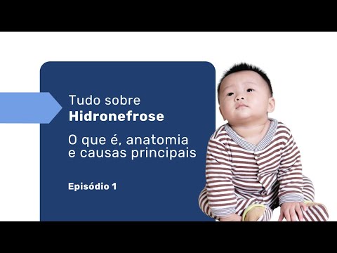 O que é hidronefrose? Conheça a anatomia e suas causas - Por Dr. Rafael Rocha - Série Ep1