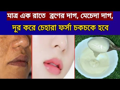 🔅মাত্র 1 দিনে চেহারার কালো দাগ, মেচেদা, ব্রণের দাগ দূর করে ত্বক চকচকে ফর্সা হবে// শুধু এটা লাগান✅️