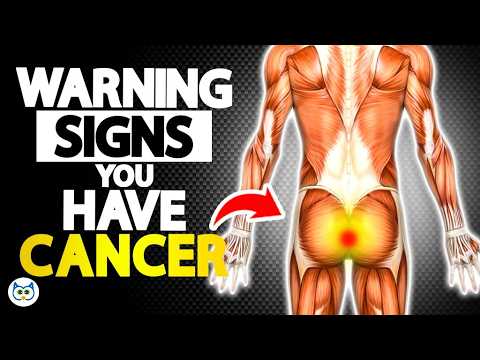 10 Cancer Symptoms You Should Never Ignore – Early Warning Signs