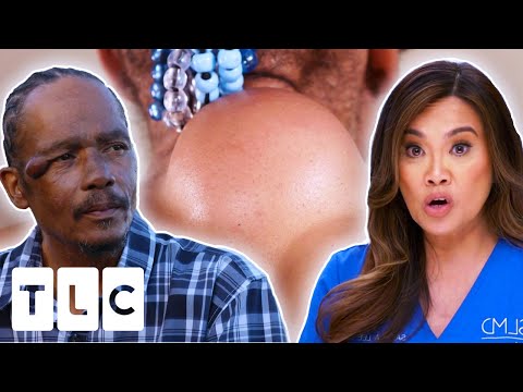 Dr. Sandra Lee Can't Believe This Patient's NEGLIGENCE Of His Health | Dr. Pimple Popper