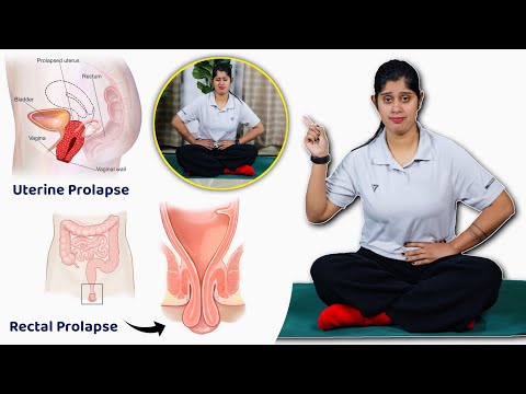 रेक्टल प्रोलैप्स और यूट्रस प्रोलैप्स के लिए योगासन | Yoga for Rectal Prolapse and Uterus Prolapse