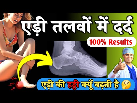 एड़ी मैं दर्द का इलाज | Heel Pain Treatment | एड़ी की हड्डी में दर्द | Plantar Fasciitis Exercises