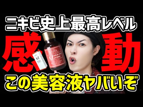 【ガチで美肌】ニキビや毛穴に悩む人必見。この美容液がオススメすぎる【コスデバハ アゼライン酸美容液】