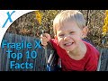 Fragile X Syndrome Overview