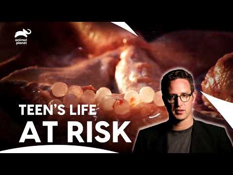 Flesh-Eating Bacteria Attacks Teen’s Knee | Monsters Inside Me | Animal Planet