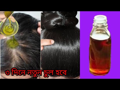 ৩ দিনে এটা লাগাও চুল পড়া বন্ধ হবে,চুল ঘন লম্বা কালো হবে, নতুন চুল গজাবে / hair growth Remedis