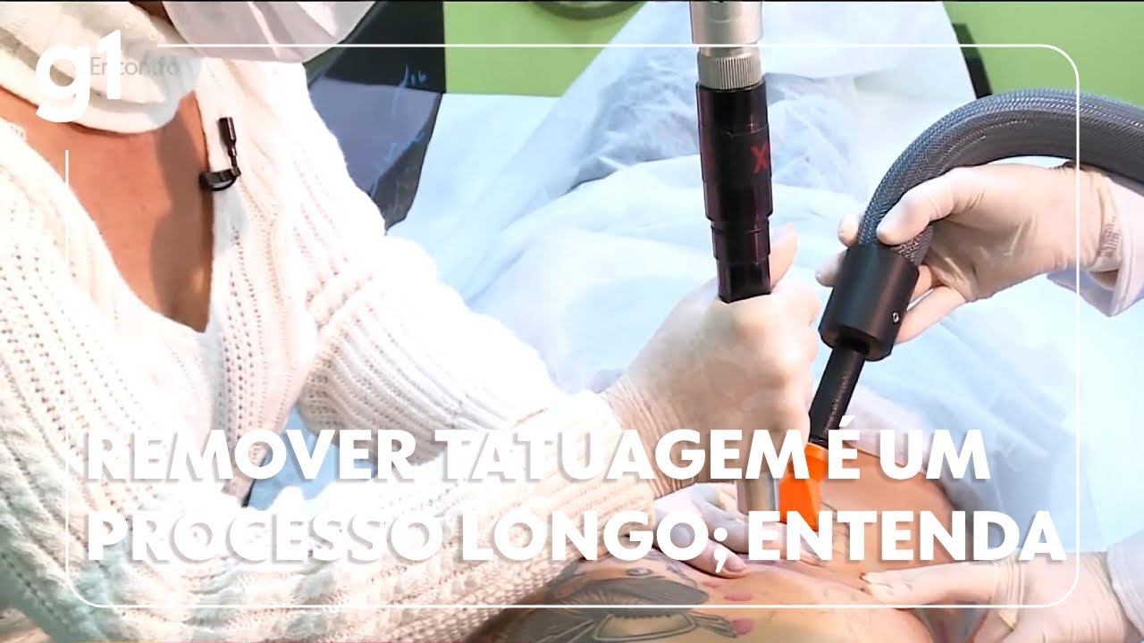 Remover tatuagens é um processo longo saiba quais são os principais cuidados bemestar