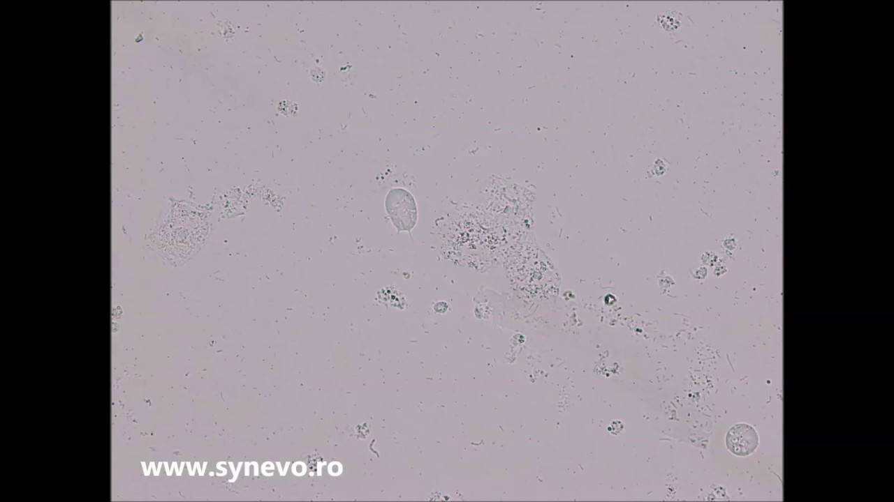 Trichomonas vaginalis