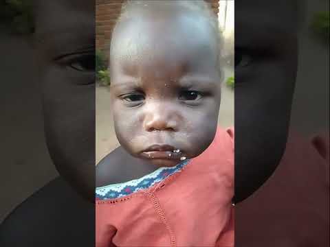 #charity #baby #childpoverty #cute #youareoneofakind #poorchild