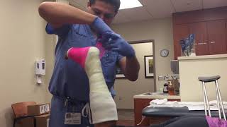 Achilles rupture Doctor visit Part 2