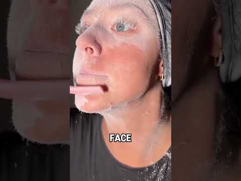 Girl’s Rare Facial Hair Disease