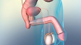 Benign Prostatic Hyperplasia (BPH) vs. Prostate Cancer