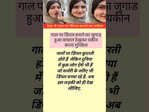 गाल पर डिंपल बनाने का जुगाड हुआ वायरल देखकर यकीन करना मुश्किल#trending #shortnews