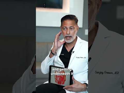 Deep Plane Facelift video 1
