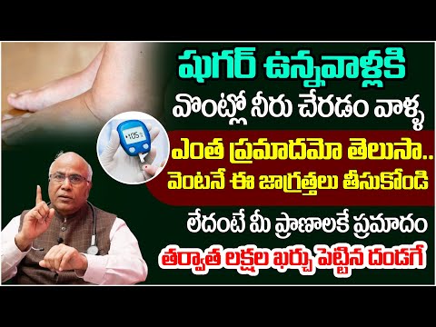 షుగర్ ఉన్నవాళ్లకి  వొంట్లో నీరు చేరడం వాళ్ళ  ఎంత ప్రమాదమో తెలుసా.. | Sugar Control Dr.CL Venkat Rao