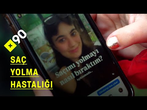 Saçlarını neden yoluyorlar? | Trikotillomani ile yaşayanlar anlattı