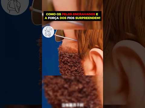 COMO É OS PELOS ENCRAVADOS E A FORÇA DOS FIOS SURPREENDEM!
