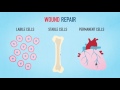 Wound Healing and Inflammation Concepts