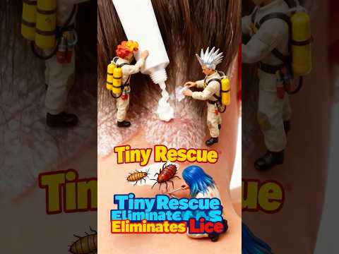 Tiny Rescue Eliminates Lice~#tiny #tinyworld #miniworld #rescue #funny