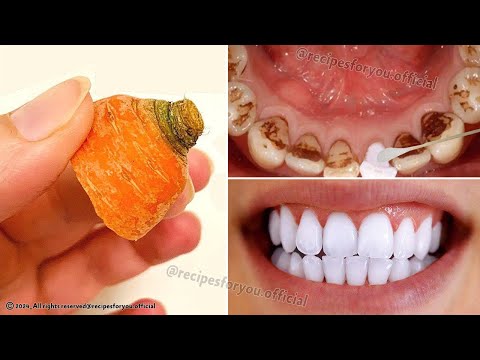 Teeth Whitening in Just 2 Minutes - Turn Yellowing and Tartar Buildup into Shiny Milky White