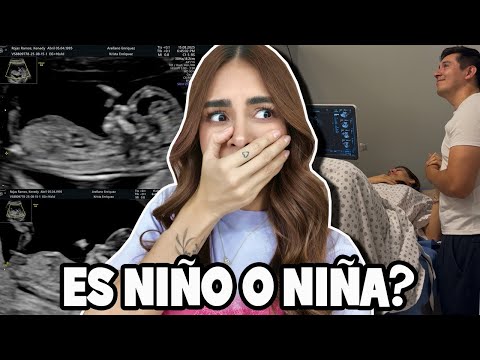 YA SABEMOS que es NUESTRO BEBÉ 🩷🩵 ¿Niño o Niña?