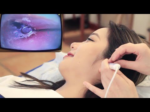 【ASMR】Experience the most professional visual ear cleaning! Dig earwax, relax ear massage!