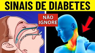 Sinais de DIABETES à NOITE + 8 Dicas Para Evitar Picos de Glicose SEM Cortar Carboidratos