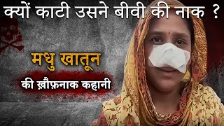 Madhu Khatoon Case | आखिर पति ने क्यों काटी बीवी की नाक?