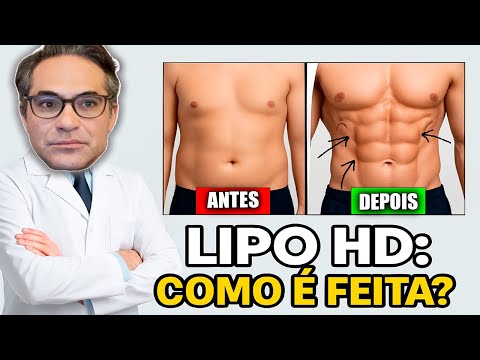Lipo HD ou Lipo LAD: qual a diferença e como é feita?