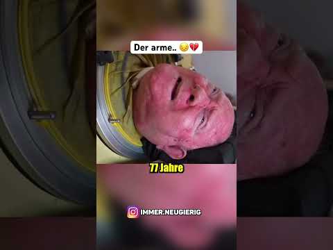 Der letzte überlebende eiserne Lunge 😳 #viral #ironlung #shorts #reels #youtubeshorts #trending