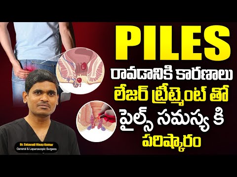 PILES - పైల్స్ సమస్యకు LASER TREATMENT తో పరిష్కారం..| Dr. Salavadi Vinay Kumar | SumanTv