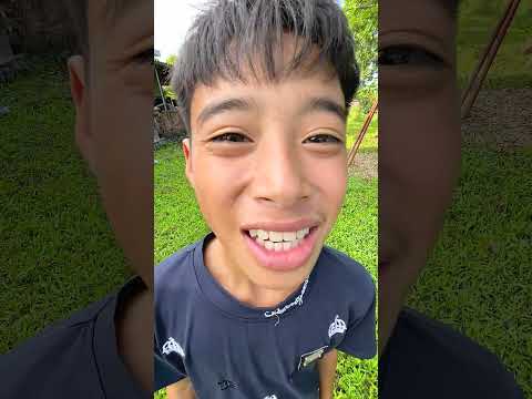 Cậu bé đáng thương và vết bớt đen trên mặt #shorts