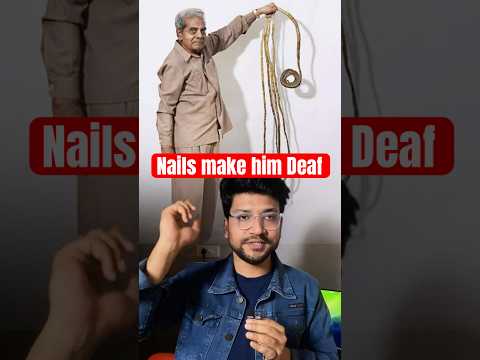 He Didn't cut finger nails from 66 years lead him deafness 😰