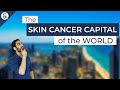 Melanoma and UV Radiation Factors