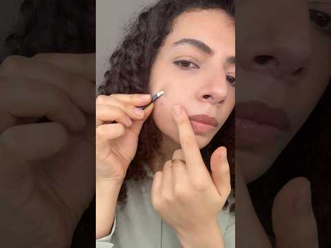 ازاي اتخلص من حبوب البشرة مع pimple patches . ازاي اتخلصت من حبوب البشرة في ٣ ايام. حل سريع للحبوب