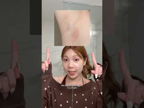 My skin was literally CRYING 😭