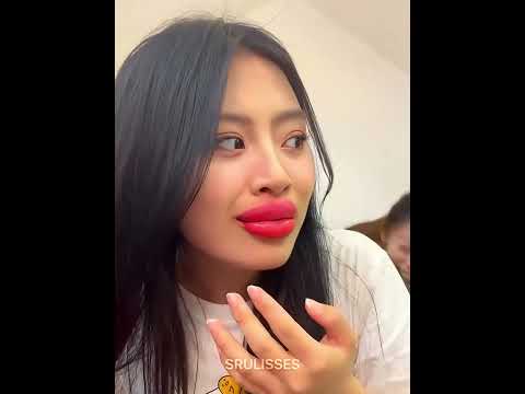 Lip Filler Prank 💀