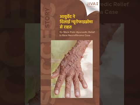 आयुर्वेद ने दिलाई न्यूरोफाइब्रोमा से राहत | #jivaayurveda #naturalhealing #ayurveda #holistichealing