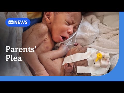 YouTube video thumbnail: PNG Conjoined Twins Should Not Be Separated Due to Risk of Death, Doctors Say