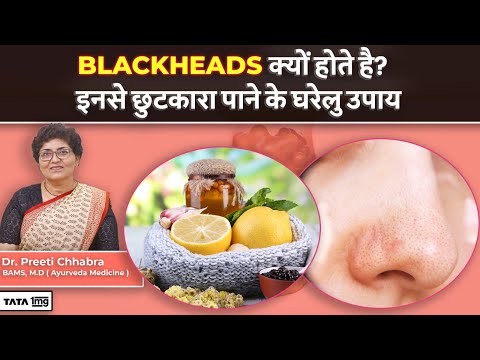 How to Remove Blackheads at Home | Natural Remedies by Dr Preeti Chhabra
